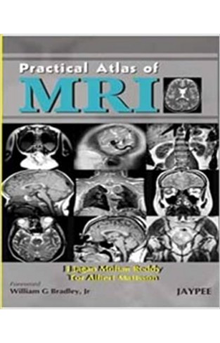 Practical Atlas of MRI - (HB)